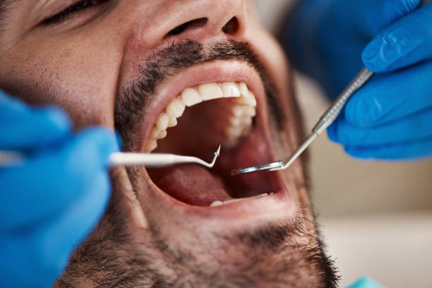 Best Cracked Tooth Emergency Dentist  in Shakopee, MN